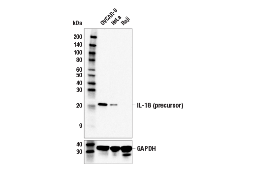 Western Blotting Image 1: IL-18 (E3G8R) Rabbit mAb