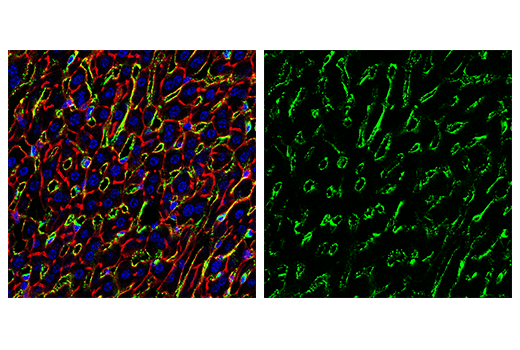 undefined Image 89: Mouse Reactive M1 vs M2 Macrophage IHC Antibody Sampler Kit