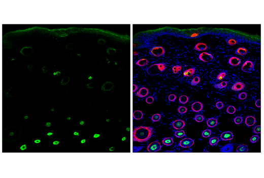 Immunofluorescence Image 1: Pan-Keratin (C11) Mouse mAb (Alexa Fluor<sup>®</sup> 488 Conjugate)