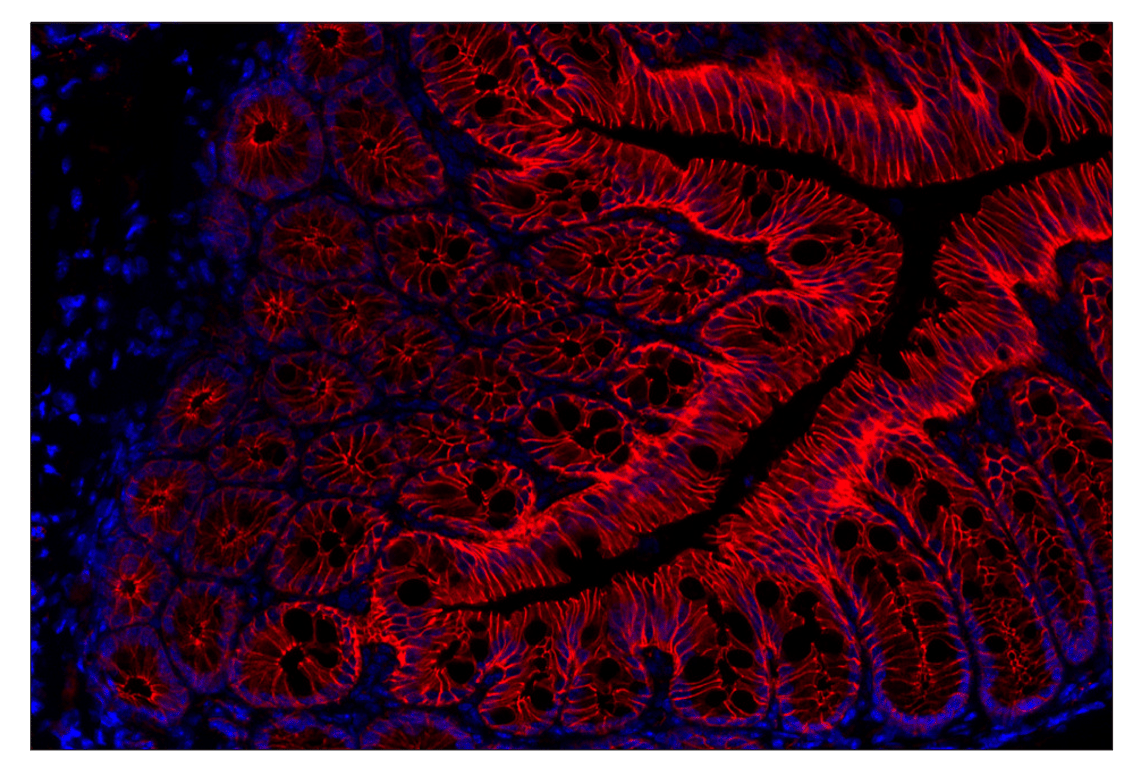 Immunohistochemistry Image 2: β-Catenin (D10A8) XP<sup>®</sup> Rabbit mAb (Alexa Fluor<sup>®</sup> 555 Conjugate)