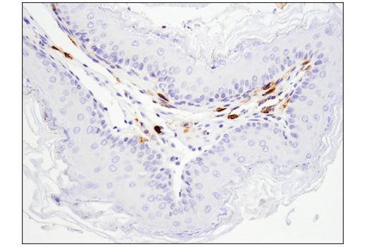 Immunohistochemistry Image 2: FcγRIIB (D8F9C) XP<sup>®</sup> Rabbit mAb