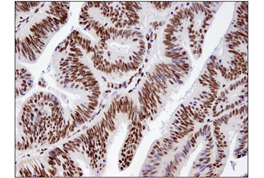 undefined Image 14: BAF Complex IHC Antibody Sampler Kit