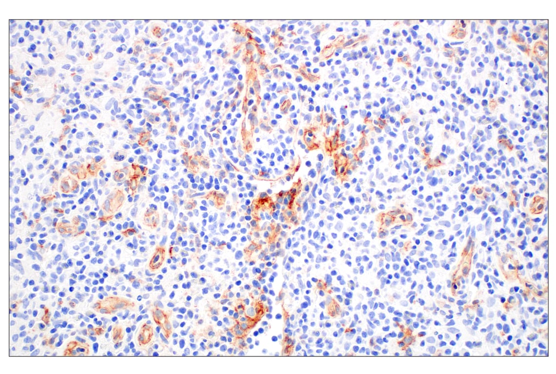 Immunohistochemistry Image 1: CD93/C1qR (E5H9B) Rabbit mAb