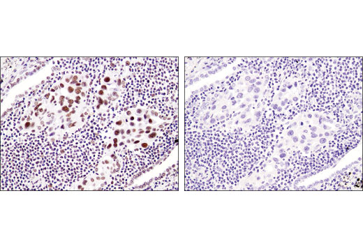 undefined Image 57: BAF Complex IHC Antibody Sampler Kit