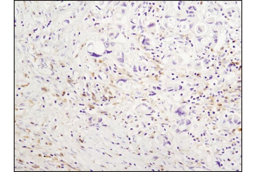 Immunohistochemistry Image 1: Syk (D3Z1E) XP<sup>®</sup> Rabbit mAb (BSA and Azide Free)