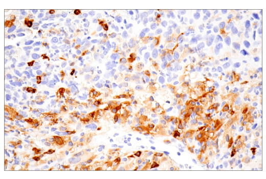 Immunohistochemistry Image 1: iNOS (E1W4J) Rabbit mAb