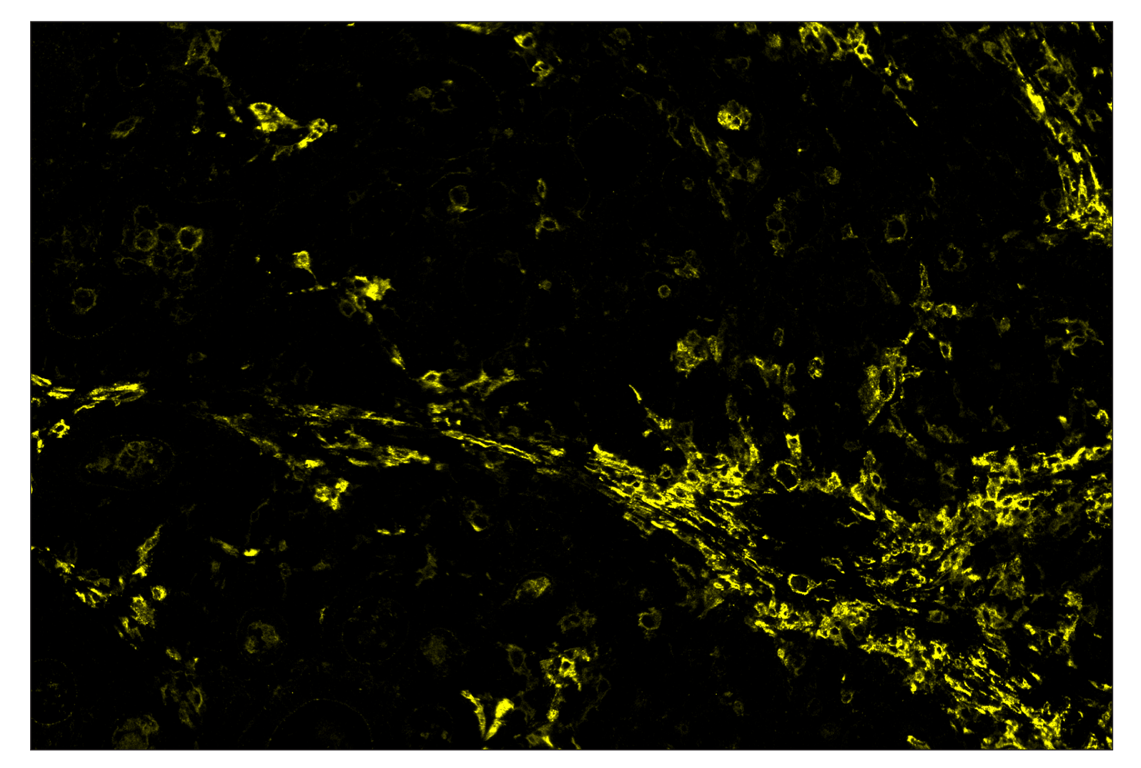 Immunohistochemistry Image 3: CD206/MRC1 (E2L9N) & CO-0035-594 SignalStar<sup>™</sup> Oligo-Antibody Pair