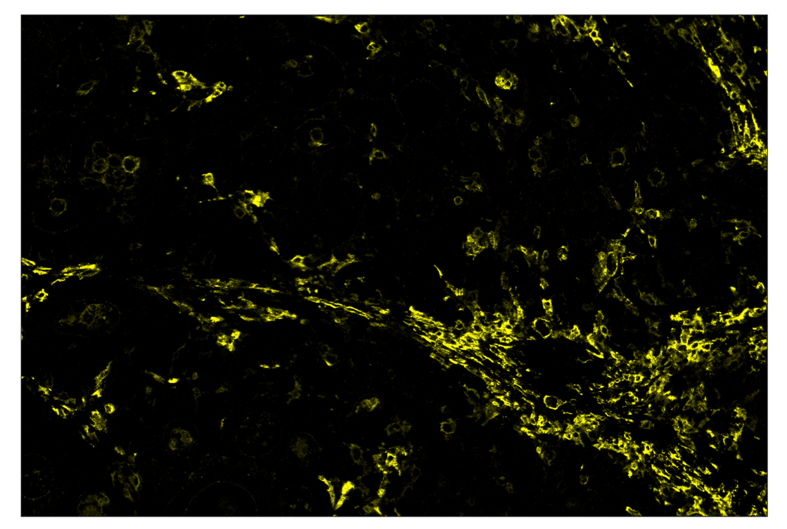 Immunohistochemistry Image 3: CD206/MRC1 (E2L9N) & CO-0035-647 SignalStar<sup>™</sup> Oligo-Antibody Pair