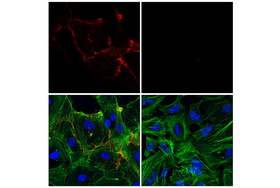 Immunofluorescence Image 1: CD31 (PECAM-1) (89C2) Mouse mAb (Alexa Fluor<sup>®</sup> 555 Conjugate)