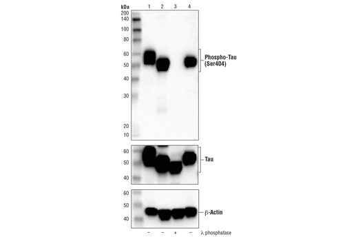 Western Blotting Image 2: Phospho-Tau (Ser404) (D2Z4G) Rabbit mAb