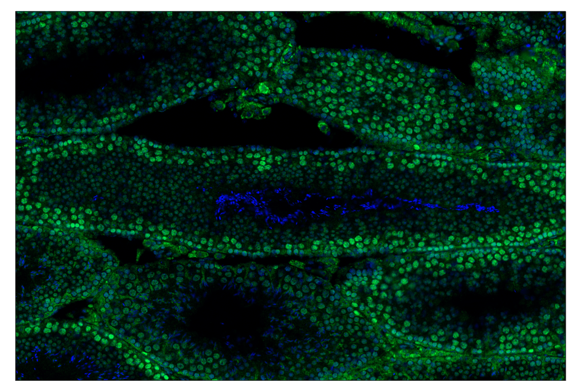 Immunohistochemistry Image 5: Ezh2 (D2C9) & CO-0167-594 SignalStar<sup>®</sup> Oligo-Antibody Pair