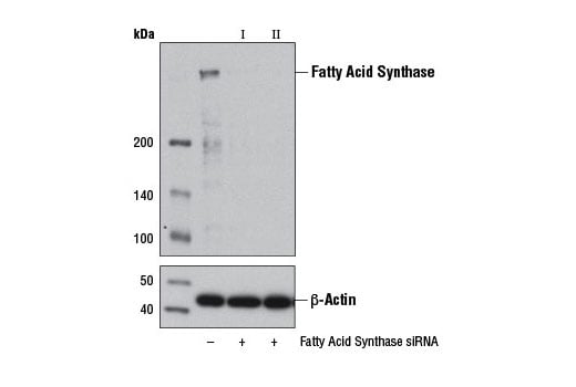 undefined Image 1: SignalSilence<sup>®</sup> Fatty Acid Synthase siRNA II