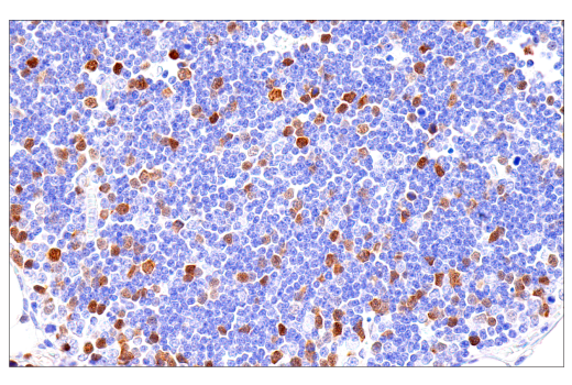 Immunohistochemistry Image 7: Cyclin A2 (E6D1J) XP<sup>®</sup> Rabbit mAb