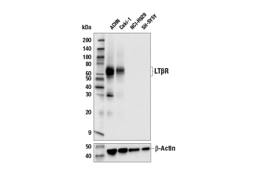 Western Blotting Image 1: LTβR (E5I6X) Rabbit mAb