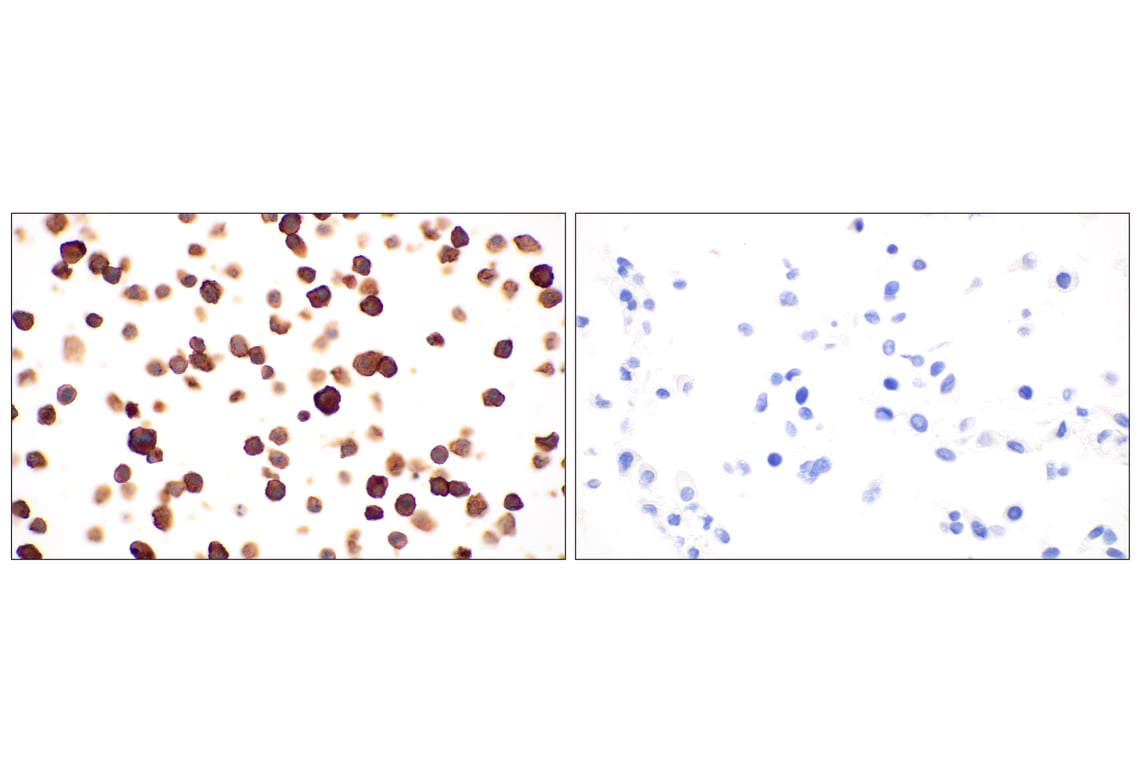 Immunohistochemistry Image 12: CD11b/ITGAM (E4K8C) Rabbit mAb