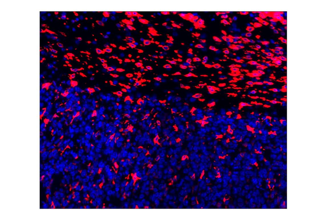 Immunohistochemistry Image 1: CD206/MRC1 (E6T5J) XP<sup>®</sup> Rabbit mAb (Alexa Fluor<sup>®</sup> 647 Conjugate)