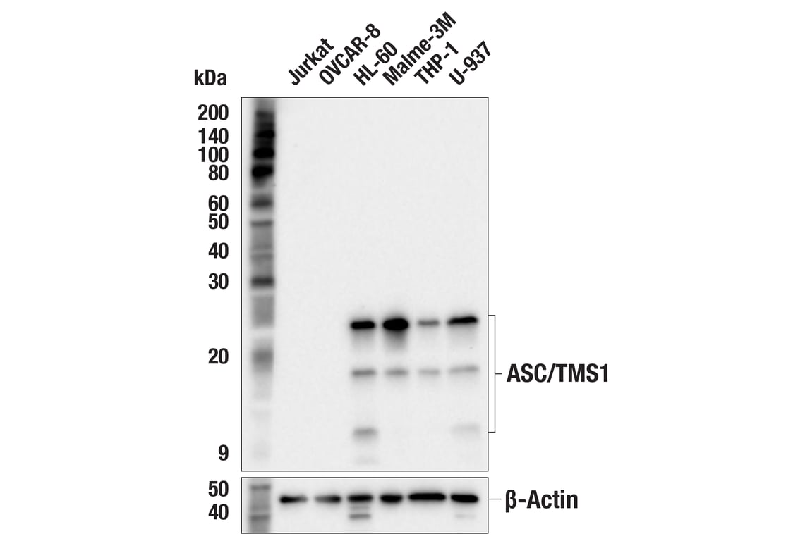 Western Blotting Image 1: ASC/TMS1 (F8U7P) Rabbit mAb