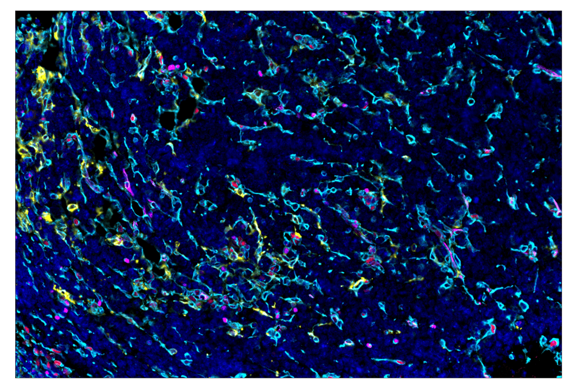 Immunohistochemistry Image 2: Phospho-SLP-76 (Ser376) (E3G9U) & CO-0018-488 SignalStar<sup>™</sup> Oligo-Antibody Pair