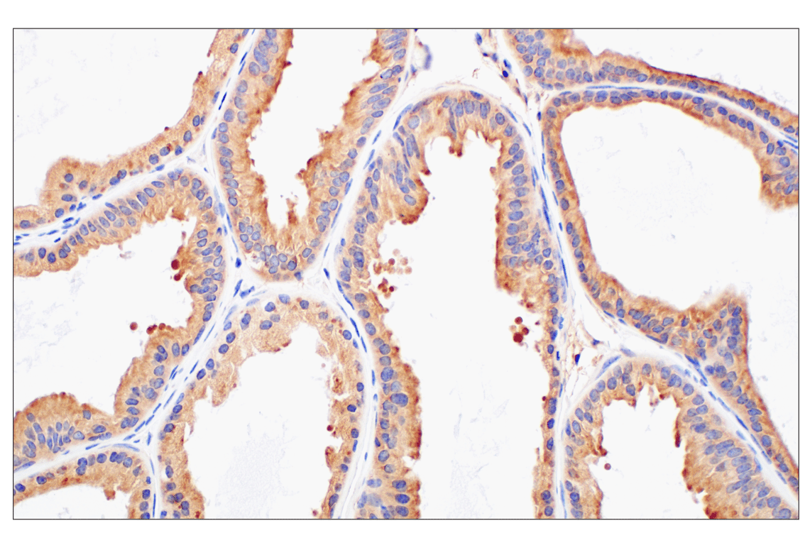 undefined Image 21: Rho-GTPase Antibody Sampler Kit