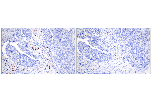 Immunohistochemistry Image 6: CD20 (E7B7T) XP<sup>®</sup> Rabbit mAb (BSA and Azide Free)