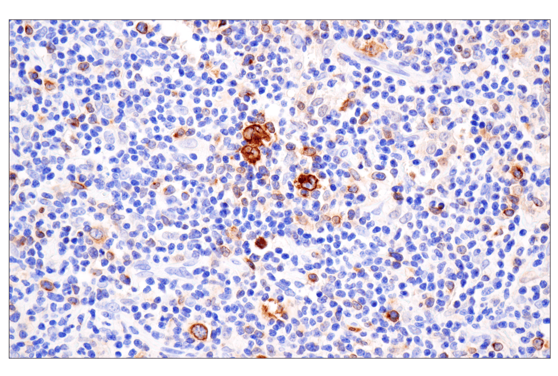 Immunohistochemistry Image 3: TNFRSF8/CD30 (E4L4I) XP<sup>®</sup> Rabbit mAb (BSA and Azide Free)