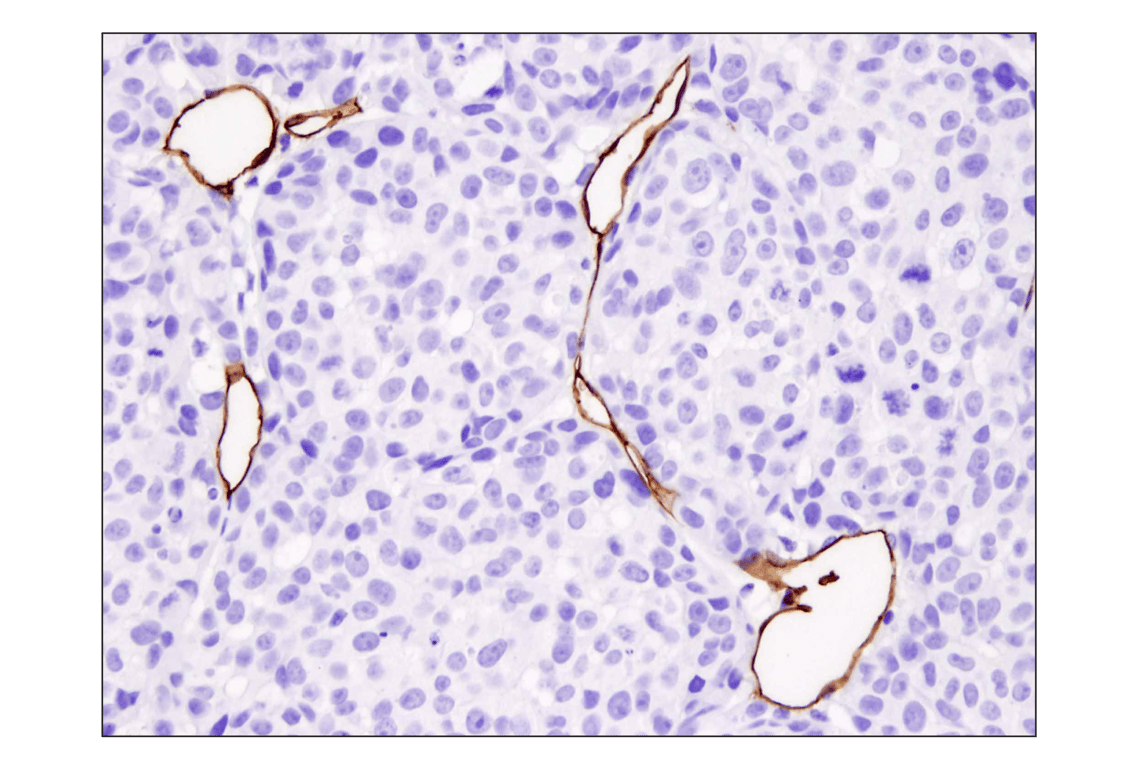 Immunohistochemistry Image 3: CD31 (PECAM-1) (D8V9E) XP<sup>®</sup> Rabbit mAb (BSA and Azide Free)