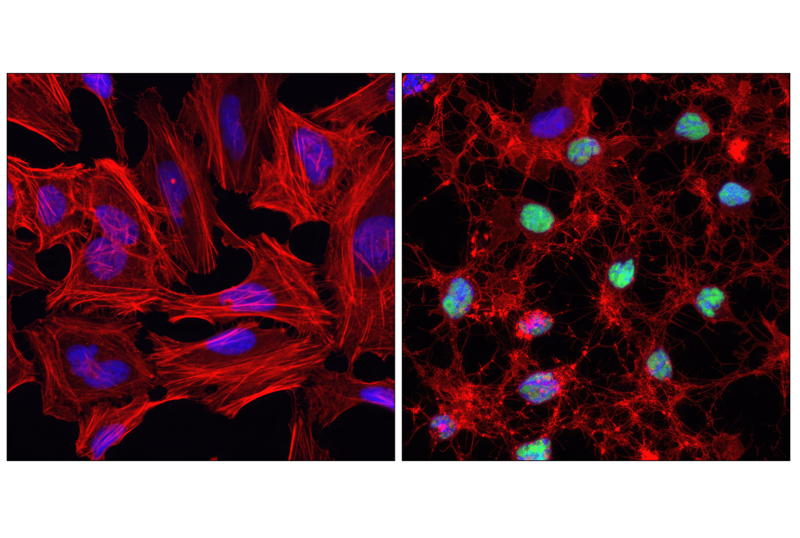 undefined Image 21: Human Reactive Cell Death and Autophagy Antibody Sampler Kit