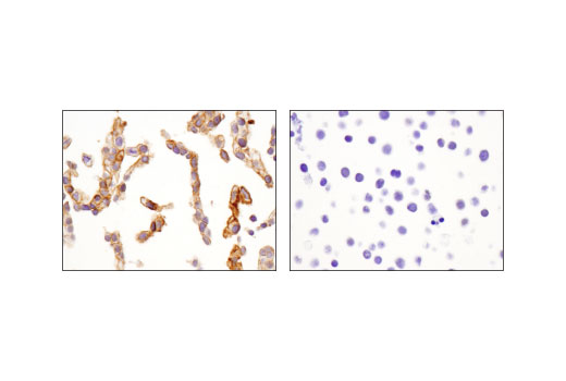 Immunohistochemistry Image 1: Jagged1 (D4Y1R) XP<sup>®</sup> Rabbit mAb