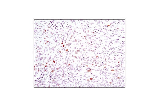 undefined Image 5: PhosphoPlus<sup>®</sup> Chk2 (Thr68) Antibody Duet