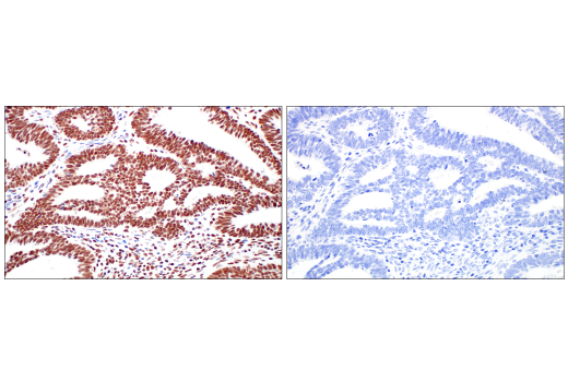 Immunohistochemistry Image 11: METTL3 (E3F2A) Rabbit mAb (BSA and Azide Free)