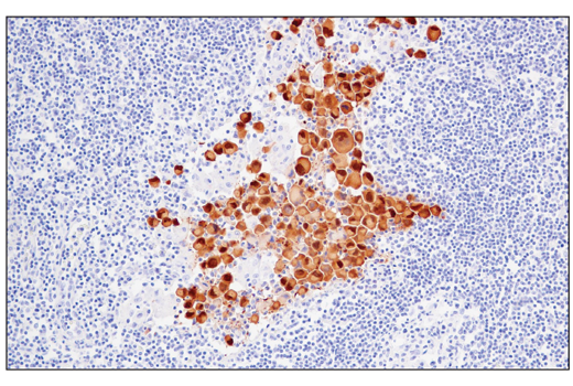 Immunohistochemistry Image 5: MAGE-A4 (E7O1U) XP<sup>®</sup> Rabbit mAb (BSA and Azide Free)