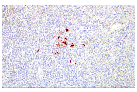 Immunohistochemistry Image 4: LAMP3/CD208 (E6E5U) XP<sup>®</sup> Rabbit mAb (BSA and Azide Free)