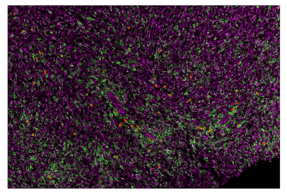 Immunohistochemistry Image 7: FoxP3 (D6O8R) & CO-0041-488 SignalStar<sup>™</sup> Oligo-Antibody Pair