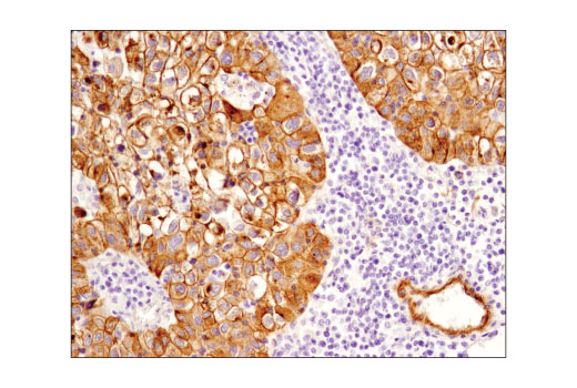 Immunohistochemistry Image 2: Jagged1 (D4Y1R) XP<sup>®</sup> Rabbit mAb