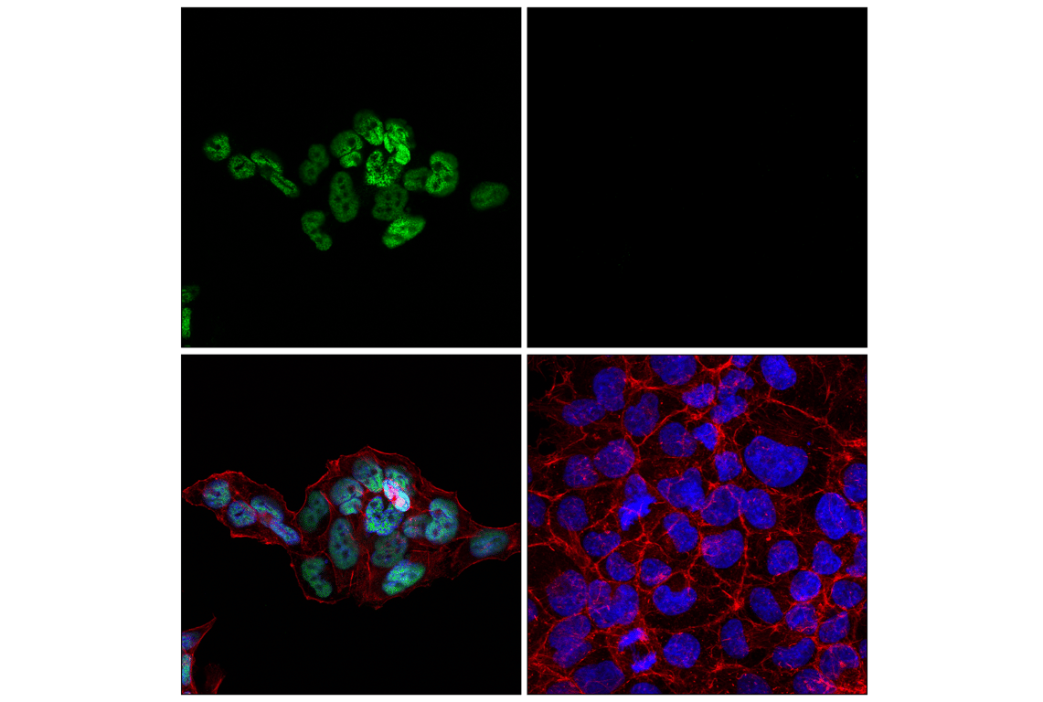 Immunofluorescence Image 1: TCF4/ITF2 (E3X2Y) Rabbit mAb