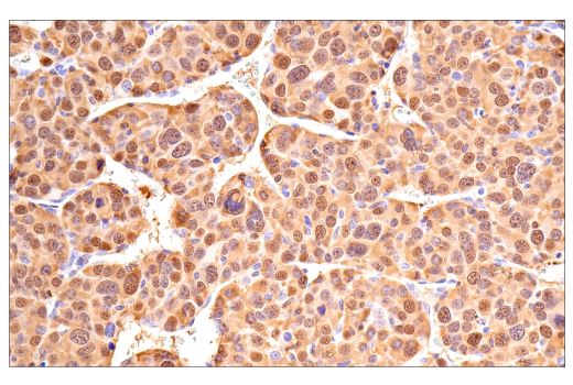 Immunohistochemistry Image 12: Galectin-3/LGALS3 (E7B6R) Rabbit mAb