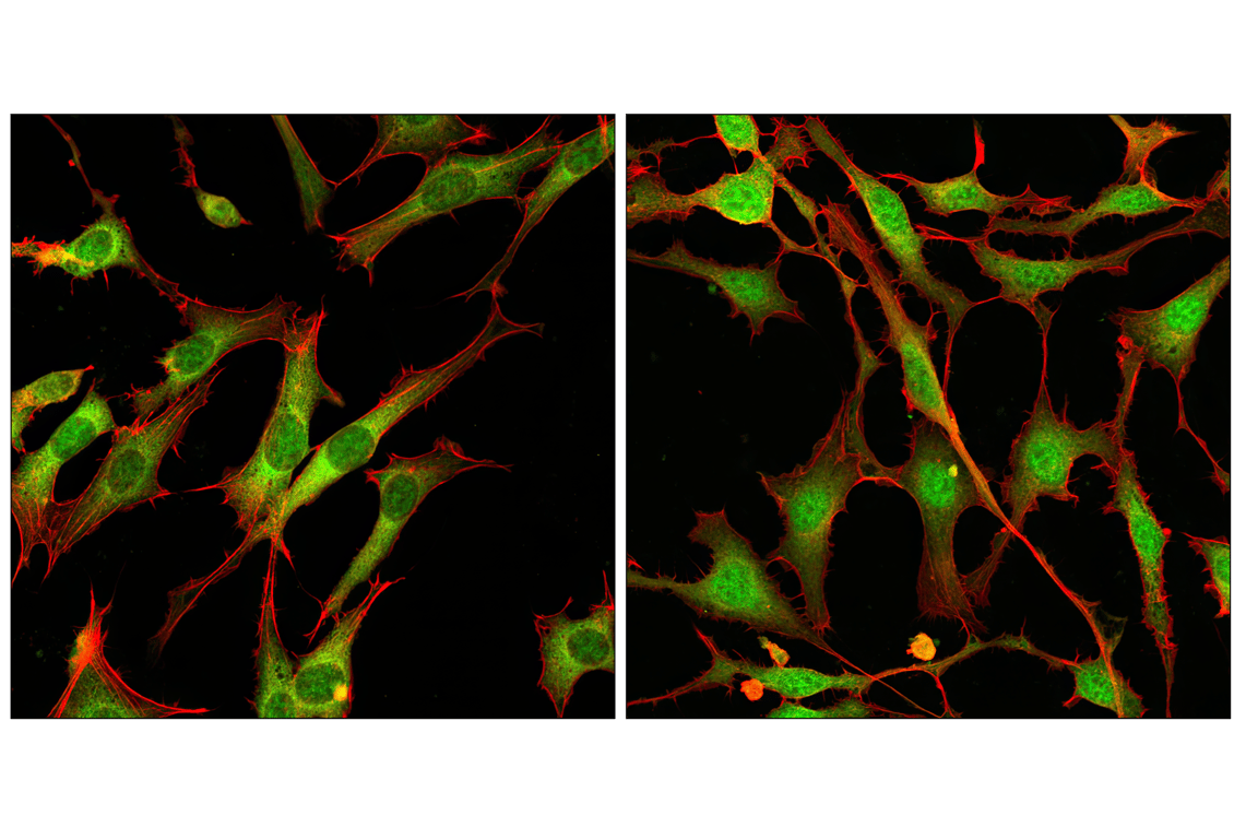 Immunofluorescence Image 1: p44/42 MAPK (Erk1/2) (137F5) Rabbit mAb