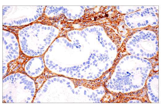 Immunohistochemistry Image 2: COL1A1 (E8F4L) XP<sup>®</sup> Rabbit mAb (BSA and Azide Free)