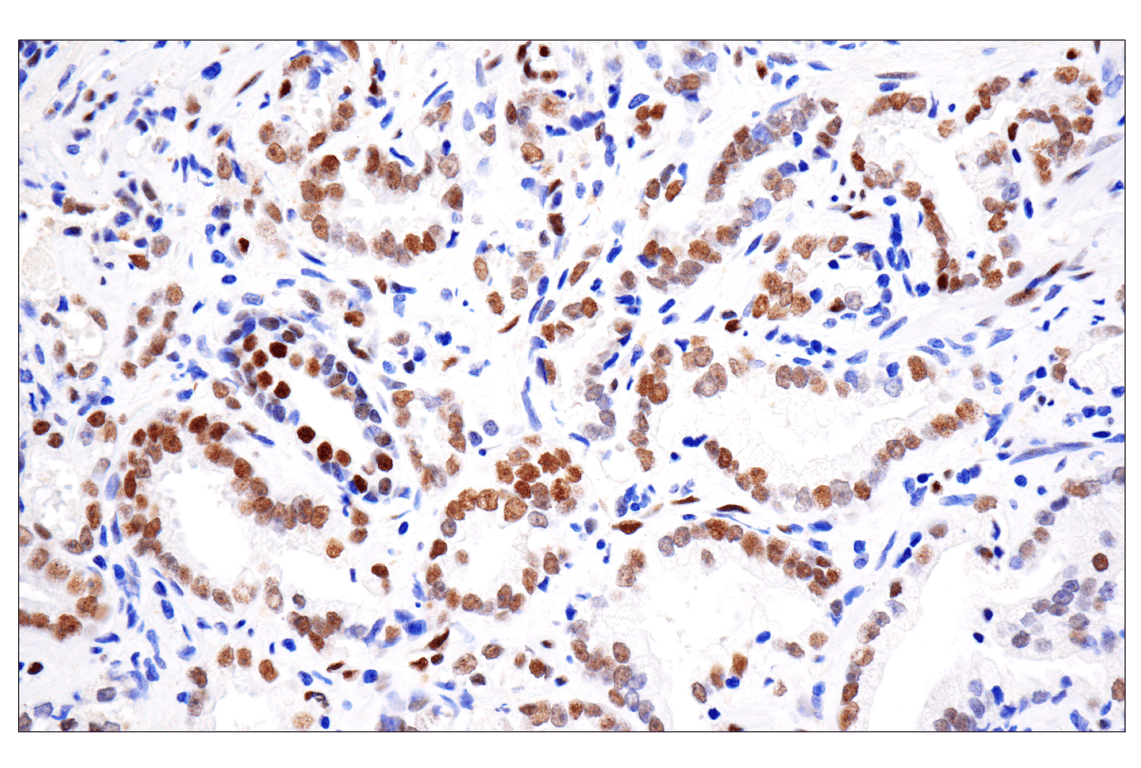 undefined Image 30: ALK Activation Antibody Sampler Kit