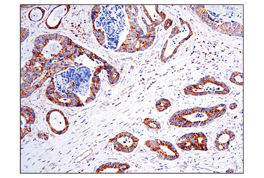 undefined Image 10: Branched-Chain Amino Acid Metabolism Antibody Sampler Kit