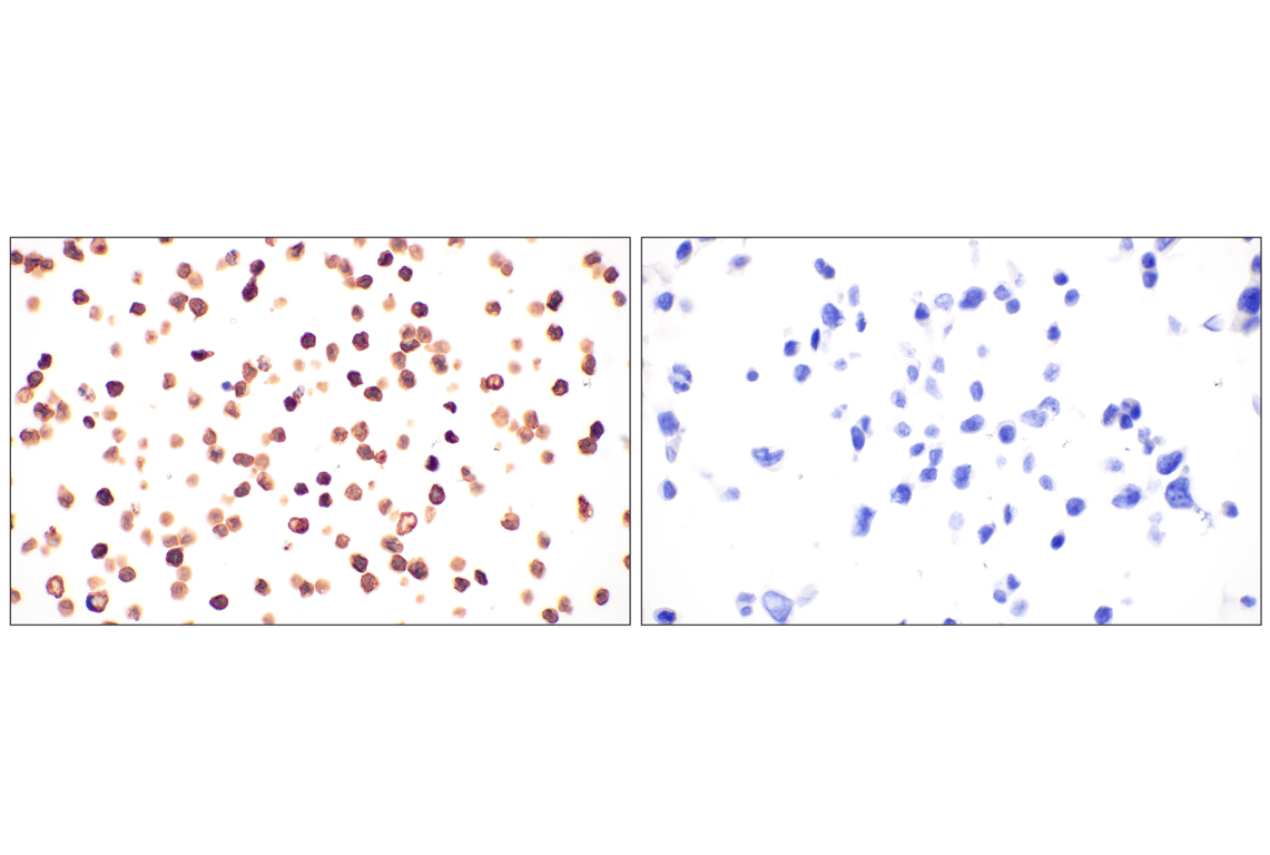 Immunohistochemistry Image 6: CD20 (E3N7O) XP<sup>®</sup> Rabbit mAb