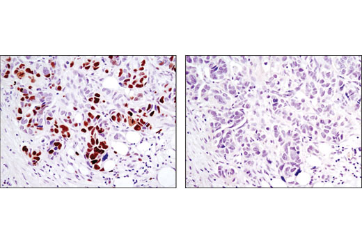 Immunohistochemistry Image 2: Phospho-Rb (Ser807/811) (D20B12) XP<sup>®</sup> Rabbit mAb (BSA and Azide Free)