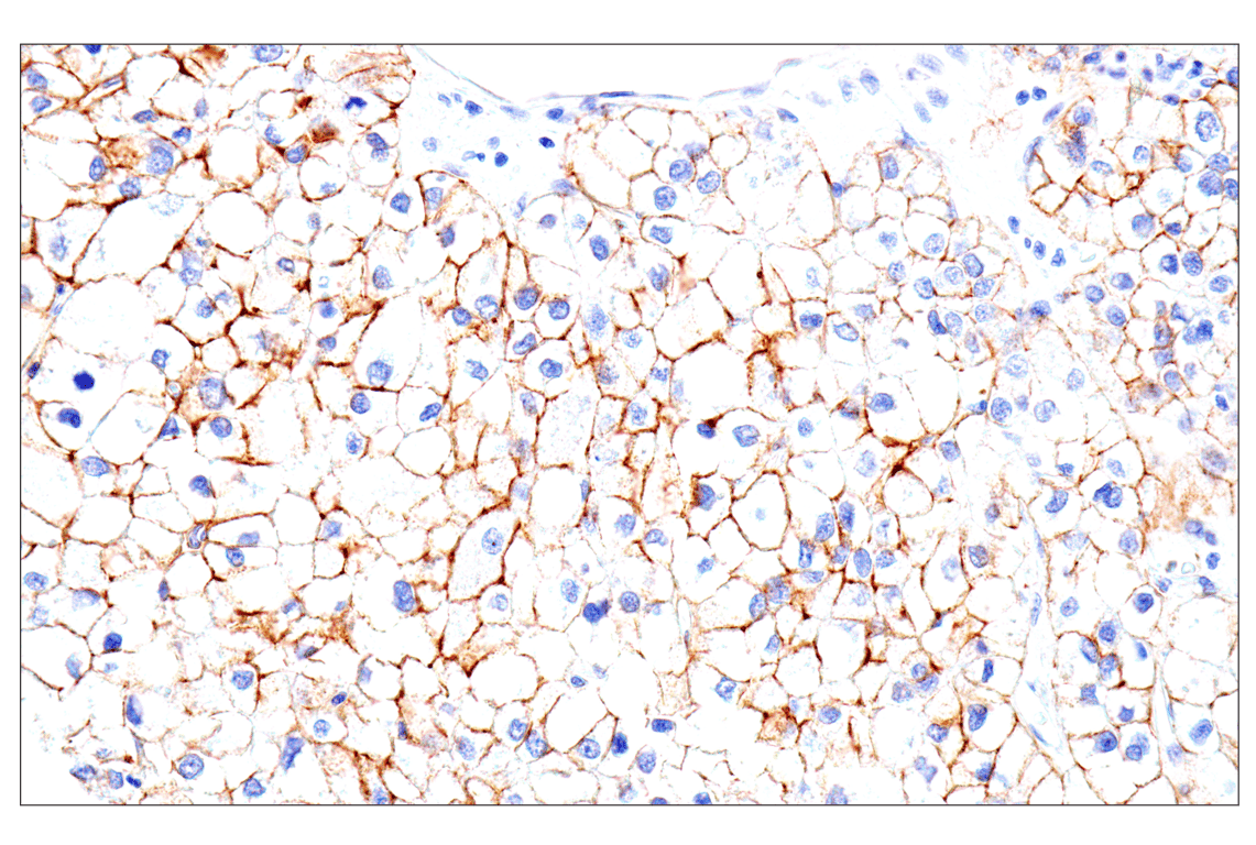 Immunohistochemistry Image 6: Syndecan 1 (E7F7T) Rabbit mAb