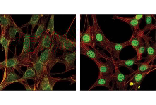 undefined Image 7: PhosphoPlus<sup>®</sup> SMAD2 (Ser465/467) Antibody Duet