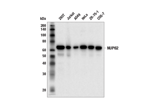 Western Blotting Image 2: NUP62 (E7H9O) Rabbit mAb