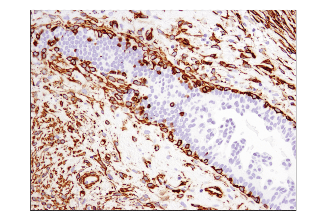 Immunohistochemistry Image 2: α-Smooth Muscle Actin (D4K9N) XP<sup>®</sup> Rabbit mAb (BSA and Azide Free)