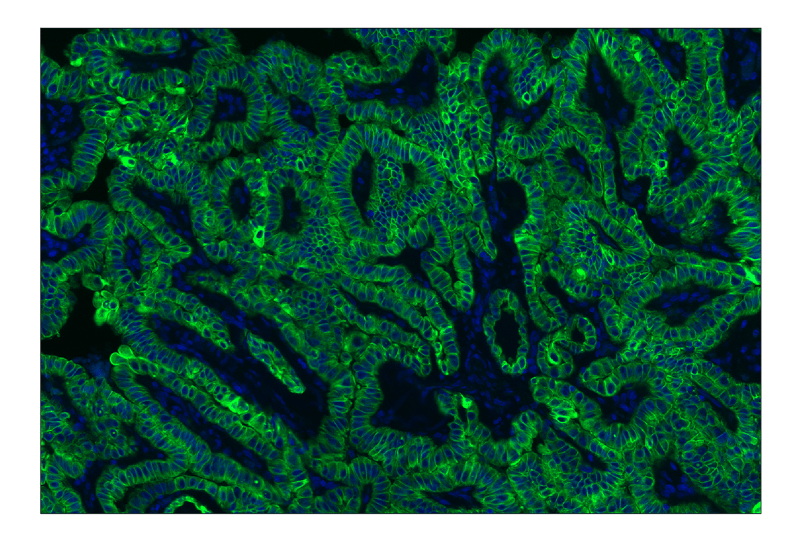 Immunohistochemistry Image 2: Pan-Keratin (Type I) (E6S1S) Rabbit mAb (Alexa Fluor<sup>®</sup> 488 Conjugate)