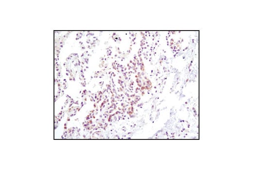 Immunohistochemistry Image 2: Jak2 (D2E12) XP<sup>®</sup> Rabbit mAb (BSA and Azide Free)