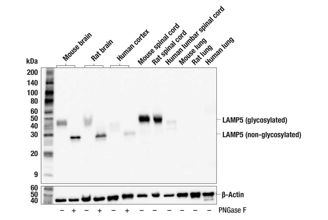 Western Blotting Image 2: LAMP5 (F9Q8X) Rabbit mAb