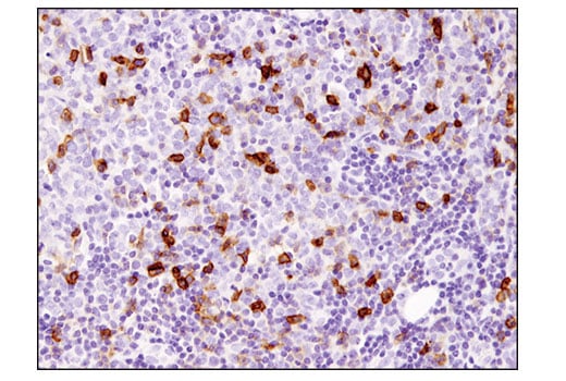 Immunohistochemistry Image 3: ICOS (D1K2T<sup>™</sup>) Rabbit mAb